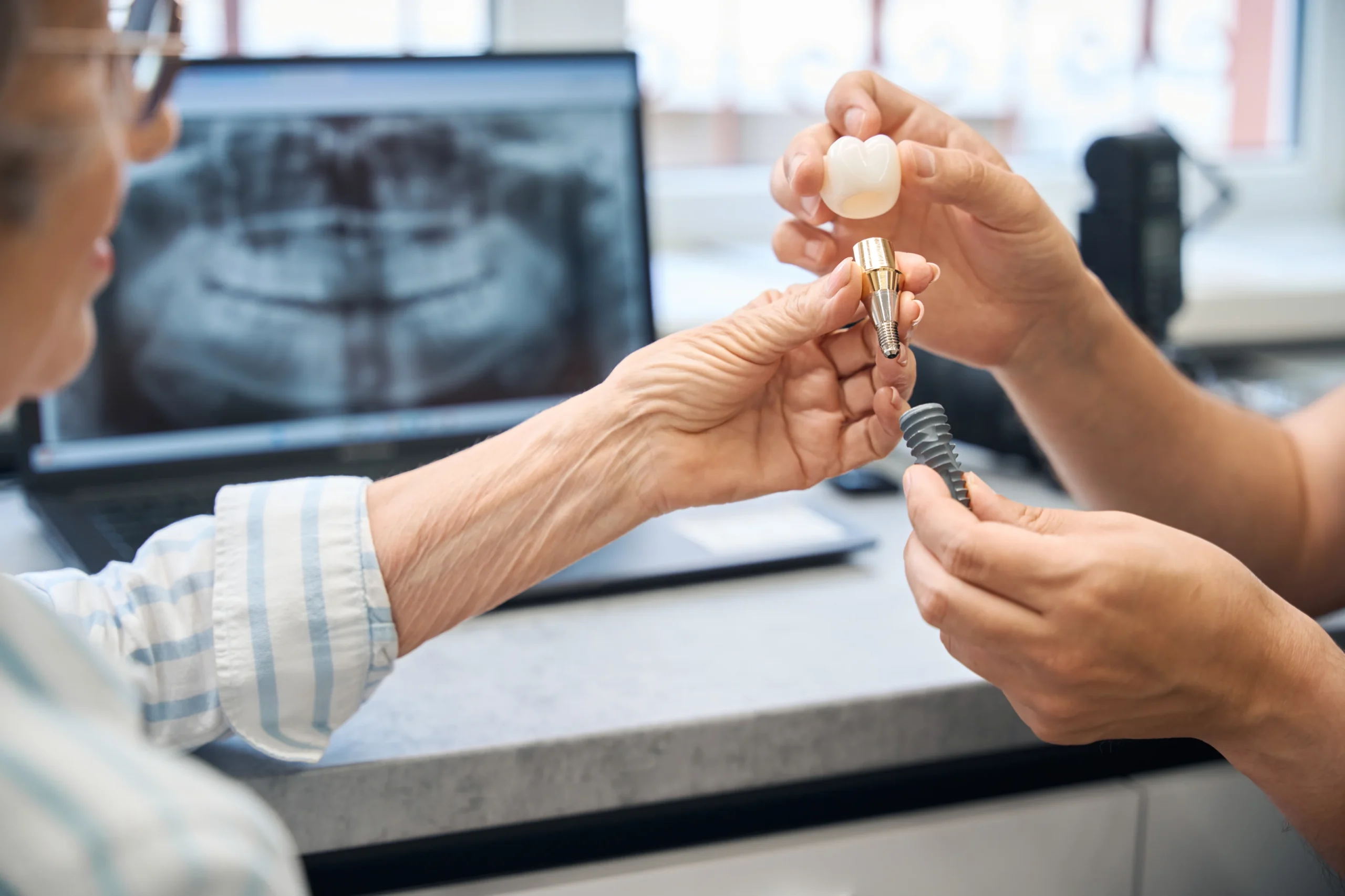 A picture of dentists holding items that symbolize a dental implant, with screws and crowns.